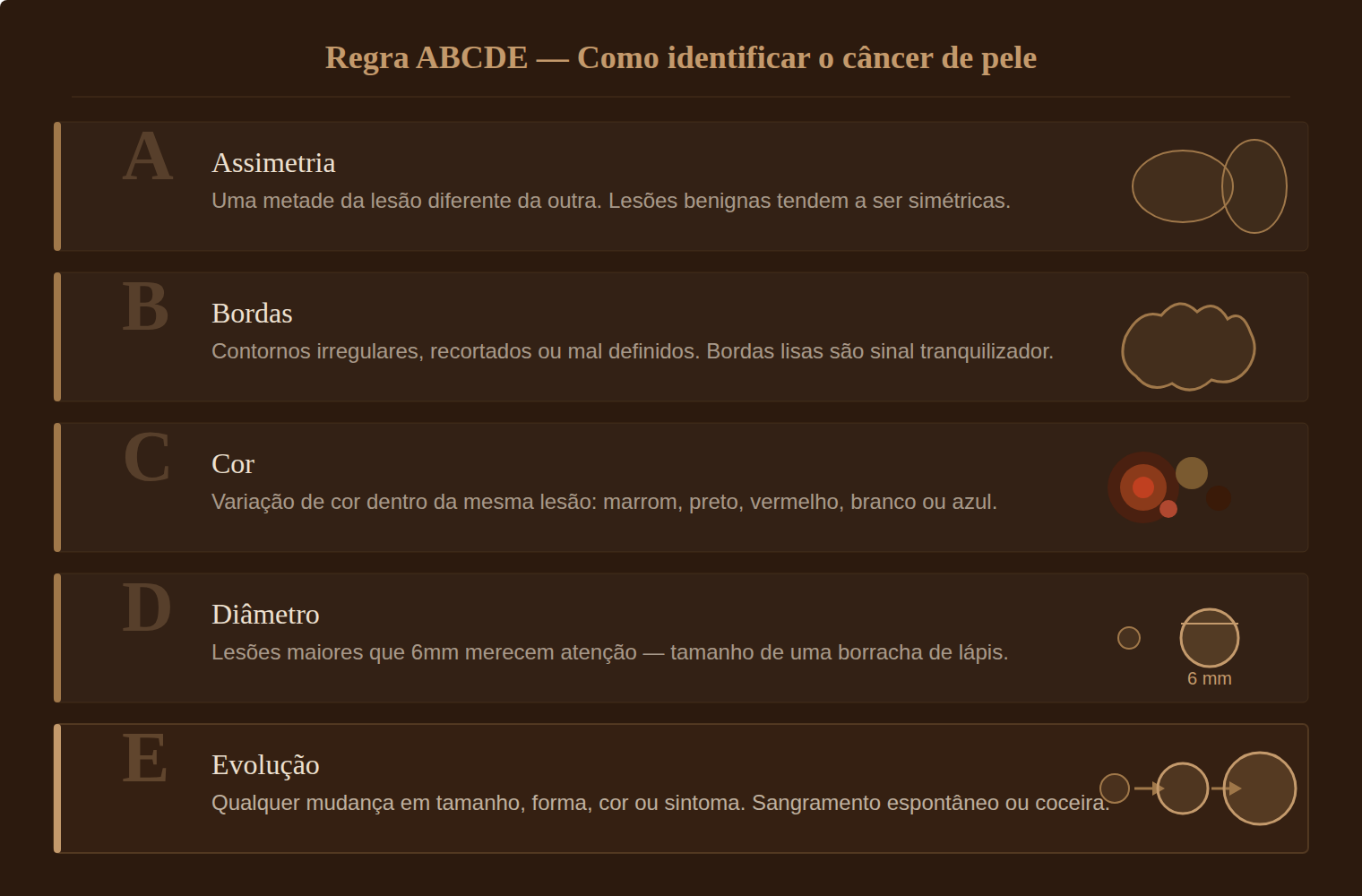 Regra ABCDE do câncer de pele — assimetria, bordas, cor, diâmetro e evolução