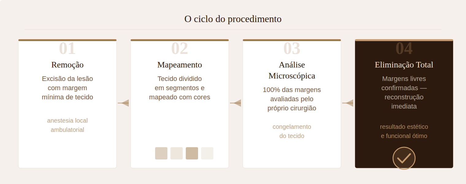 Os 4 passos da Cirurgia Micrográfica de Mohs — remoção, mapeamento, análise e reconstrução